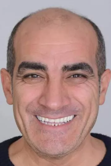 Мурат Джошкун